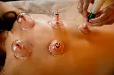 Cupping Yin-Yang Harmony